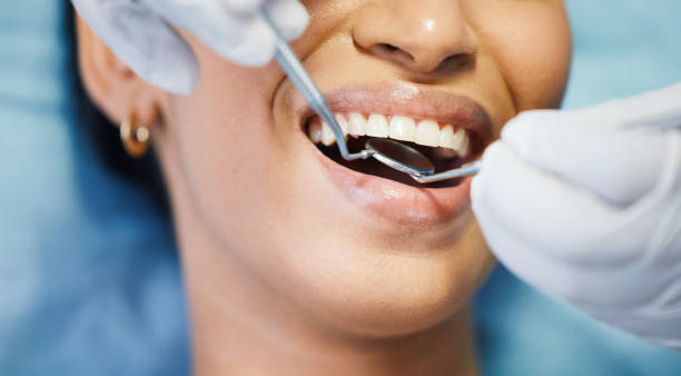 Teeth Whitening in MN